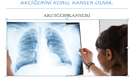 AKCİĞERİNİ KORU, KANSER OLMA